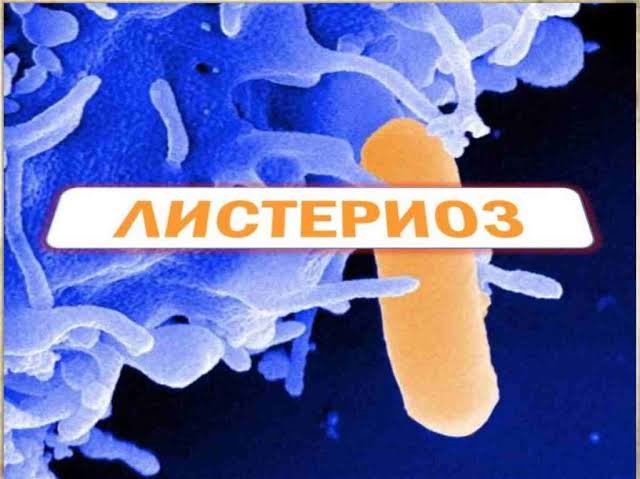 Листериоз. Эпидемиология. Профилактика.